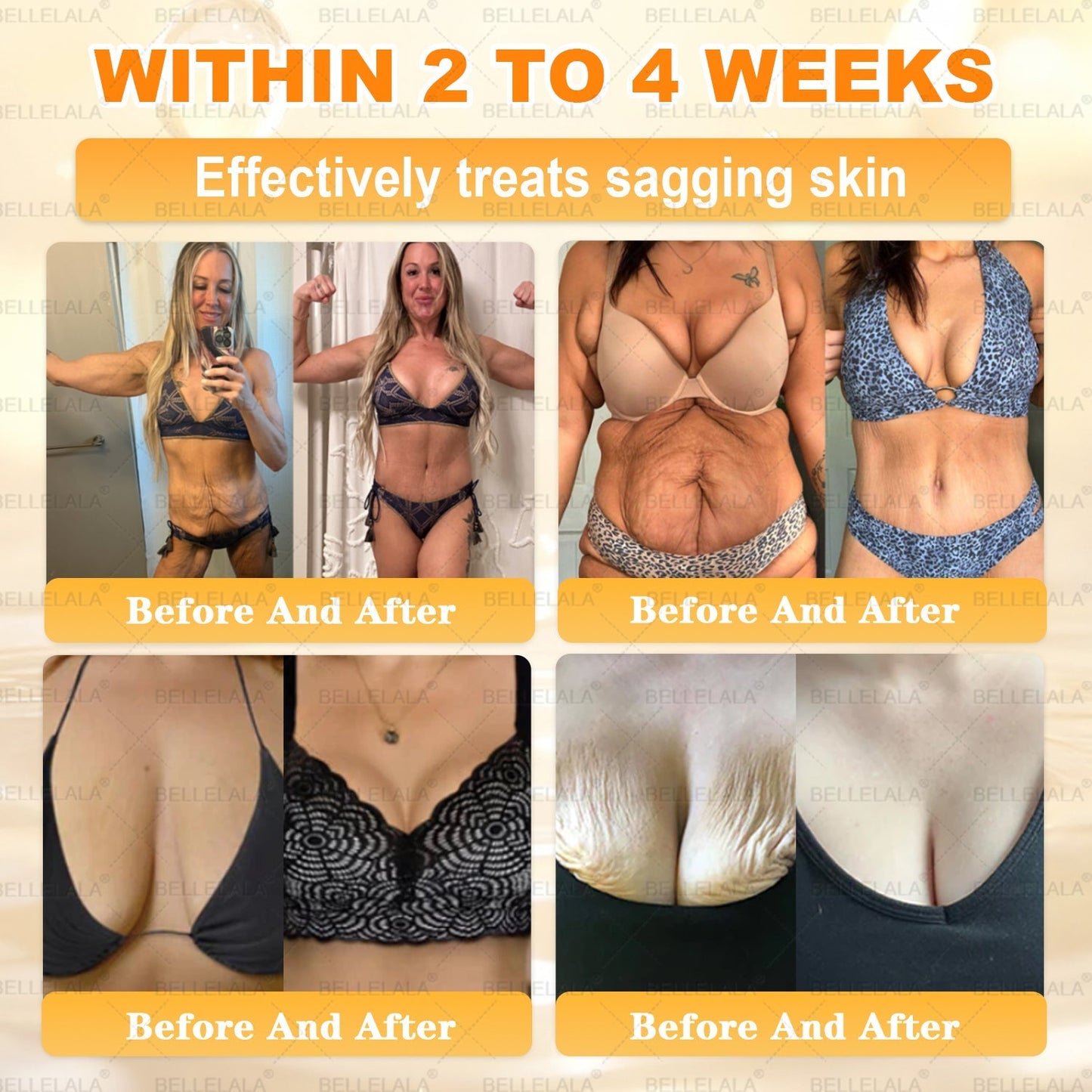 NEW & IMPROVED 🥇𝐁𝐞𝐥𝐥𝐞𝐥𝐚𝐥𝐚® 𝐁𝐞𝐞 𝐯𝐞𝐧𝐨𝐦 𝐒𝐤𝐢𝐧 𝐑𝐞𝐬𝐭𝐨𝐫𝐚𝐭𝐢𝐨𝐧 𝐂𝐫𝐞𝐚𝐦