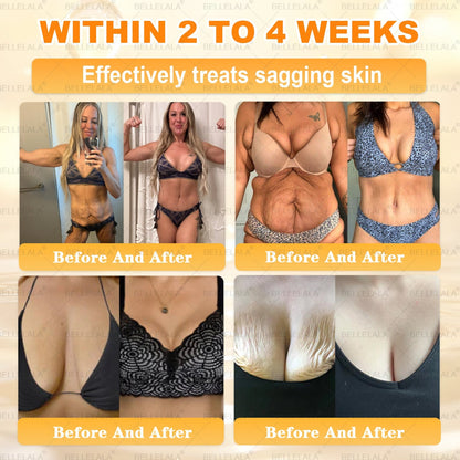 NEW & IMPROVED 🥇𝐁𝐞𝐥𝐥𝐞𝐥𝐚𝐥𝐚® 𝐁𝐞𝐞 𝐯𝐞𝐧𝐨𝐦 𝐒𝐤𝐢𝐧 𝐑𝐞𝐬𝐭𝐨𝐫𝐚𝐭𝐢𝐨𝐧 𝐂𝐫𝐞𝐚𝐦