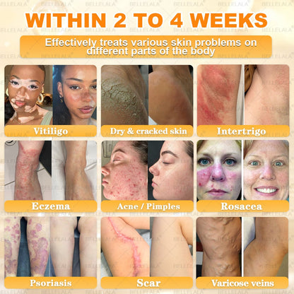 NEW & IMPROVED 🥇𝐁𝐞𝐥𝐥𝐞𝐥𝐚𝐥𝐚® 𝐁𝐞𝐞 𝐯𝐞𝐧𝐨𝐦 𝐒𝐤𝐢𝐧 𝐑𝐞𝐬𝐭𝐨𝐫𝐚𝐭𝐢𝐨𝐧 𝐂𝐫𝐞𝐚𝐦