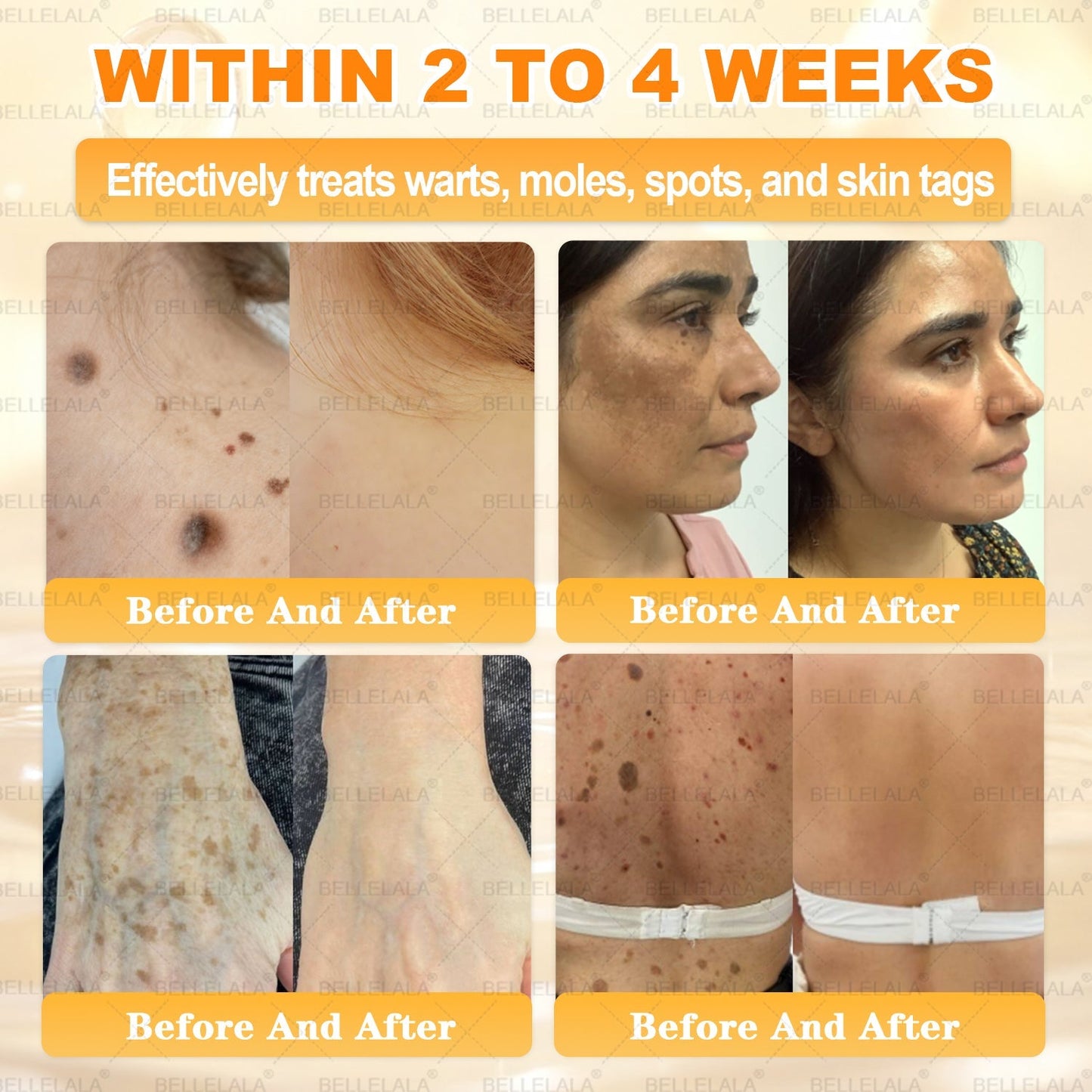 NEW & IMPROVED 🥇𝐁𝐞𝐥𝐥𝐞𝐥𝐚𝐥𝐚® 𝐁𝐞𝐞 𝐯𝐞𝐧𝐨𝐦 𝐒𝐤𝐢𝐧 𝐑𝐞𝐬𝐭𝐨𝐫𝐚𝐭𝐢𝐨𝐧 𝐂𝐫𝐞𝐚𝐦