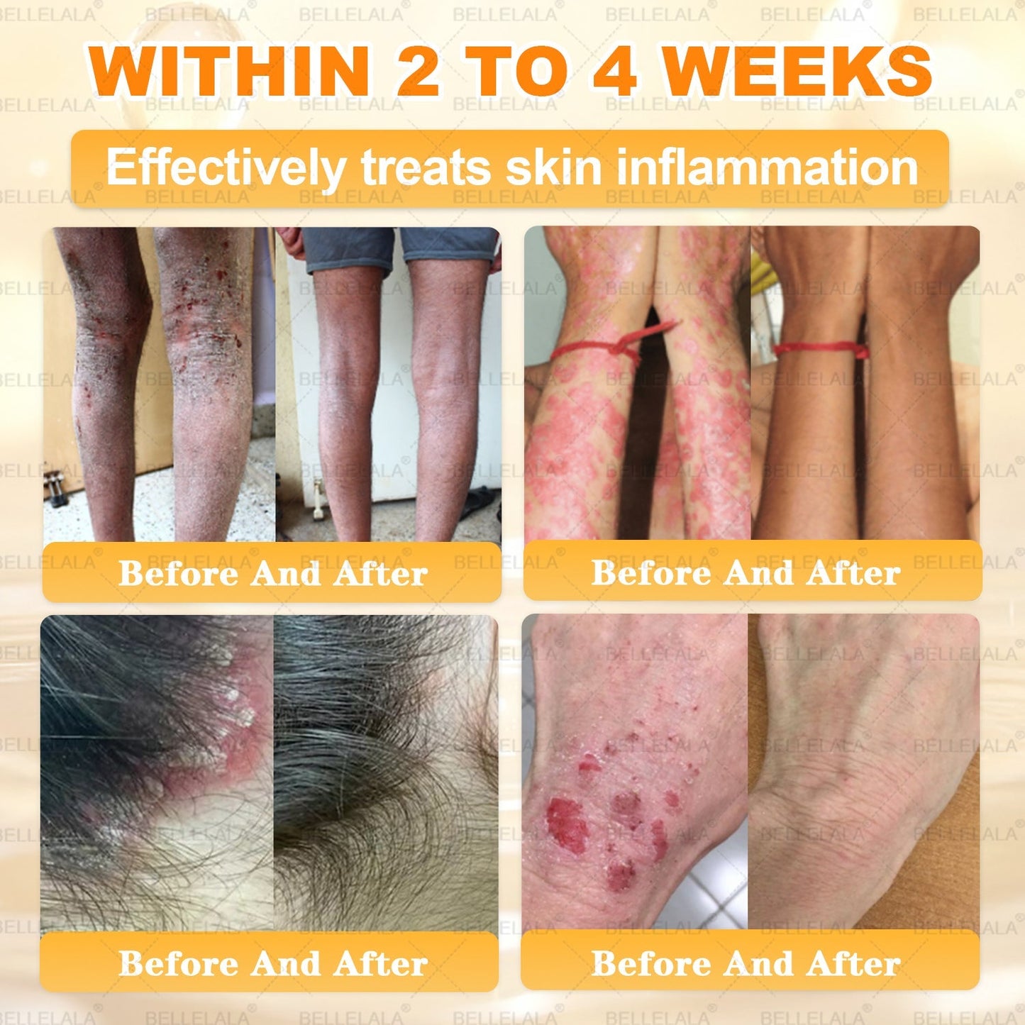 NEW & IMPROVED 🥇𝐁𝐞𝐥𝐥𝐞𝐥𝐚𝐥𝐚® 𝐁𝐞𝐞 𝐯𝐞𝐧𝐨𝐦 𝐒𝐤𝐢𝐧 𝐑𝐞𝐬𝐭𝐨𝐫𝐚𝐭𝐢𝐨𝐧 𝐂𝐫𝐞𝐚𝐦