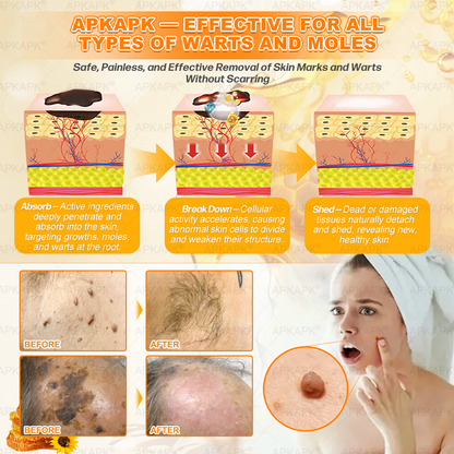 NEW & IMPROVED 🥇𝐁𝐞𝐥𝐥𝐞𝐥𝐚𝐥𝐚® 𝐁𝐞𝐞 𝐯𝐞𝐧𝐨𝐦 𝐒𝐤𝐢𝐧 𝐑𝐞𝐬𝐭𝐨𝐫𝐚𝐭𝐢𝐨𝐧 𝐂𝐫𝐞𝐚𝐦