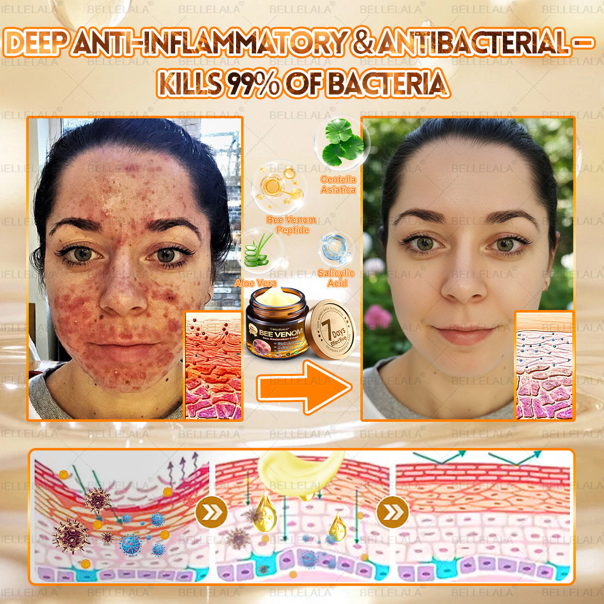 NEW & IMPROVED 🥇𝐁𝐞𝐥𝐥𝐞𝐥𝐚𝐥𝐚® 𝐁𝐞𝐞 𝐯𝐞𝐧𝐨𝐦 𝐒𝐤𝐢𝐧 𝐑𝐞𝐬𝐭𝐨𝐫𝐚𝐭𝐢𝐨𝐧 𝐂𝐫𝐞𝐚𝐦